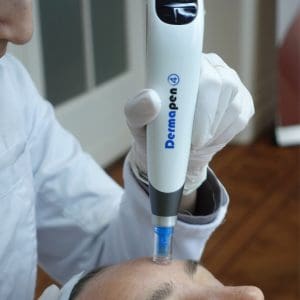dermapen