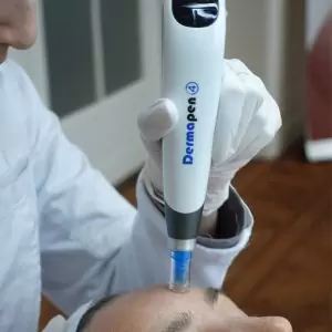 dermapen